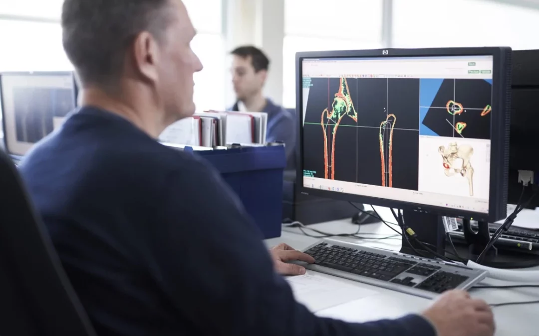 Planification 3D de la prothèse de hanche : une chirurgie sur mesure